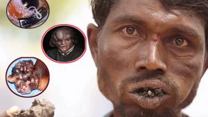 10 căn bệnh đáng sợ vô phương cứu chữa chỉ nhìn qua cũng đủ rùng mình