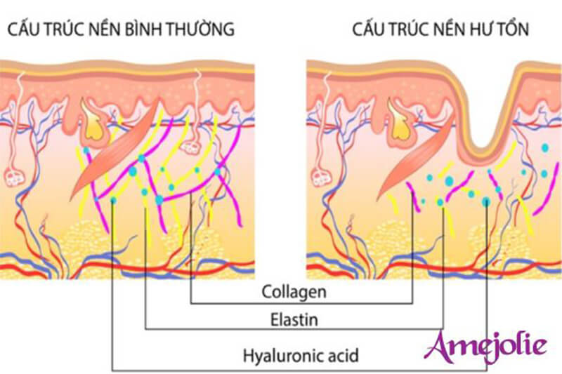 collagen-pizkie-1