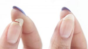 Mơ thấy móng tay gãy là điềm dữ tới!