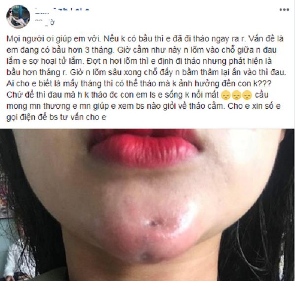 thao-mieng-don-cam-2