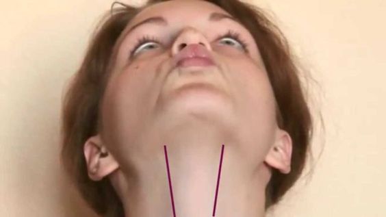 phau-thuat-don-cam-2