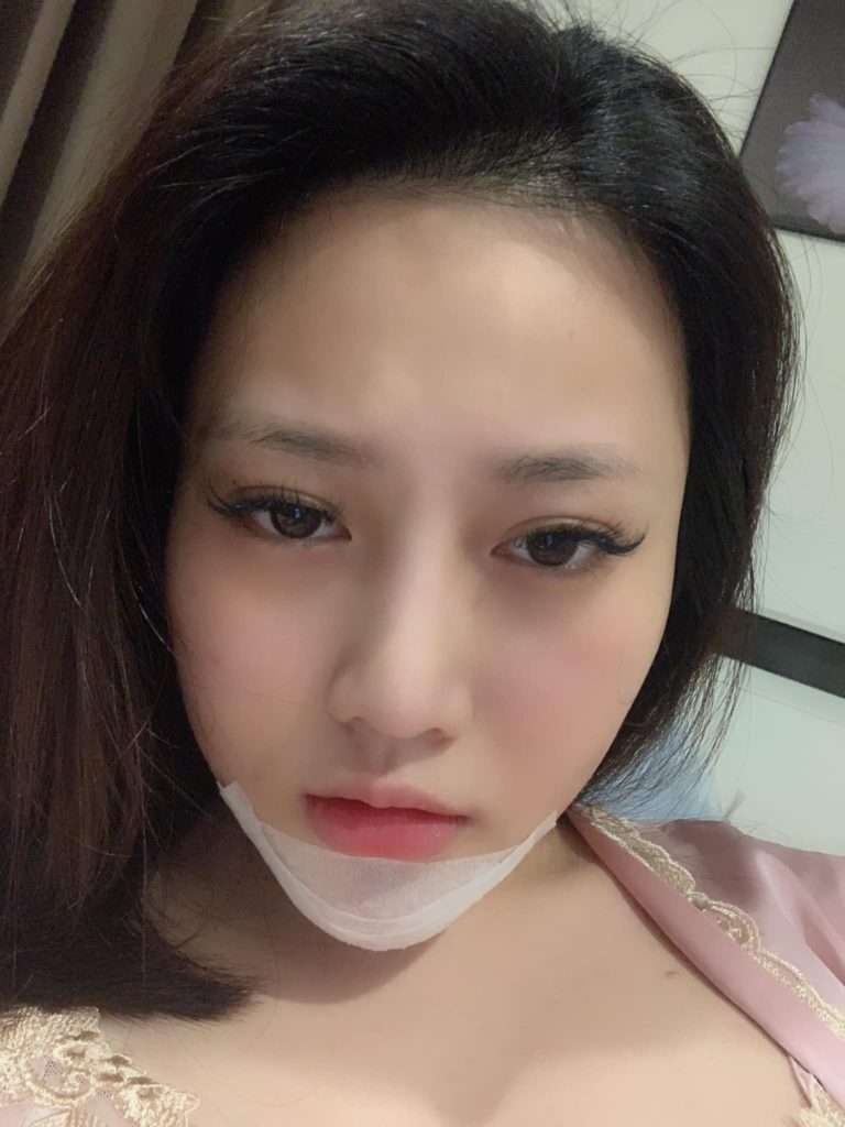 phau-thuat-don-cam-11