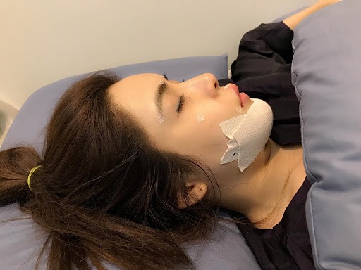 thao-mieng-don-cam-1